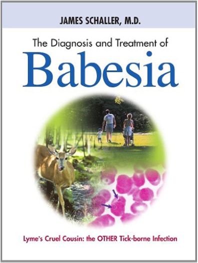 diagnosis and treatment of babesia 390