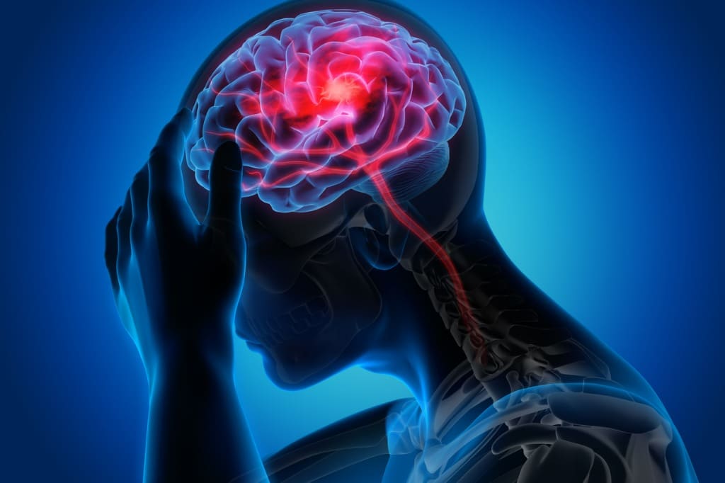 man with brain stroke symptoms.jpg s1024x1024wisk20czWq4wd03hKzmXbdUQ YjBjmnR4R1tSKIR3h8ZDdaQD8