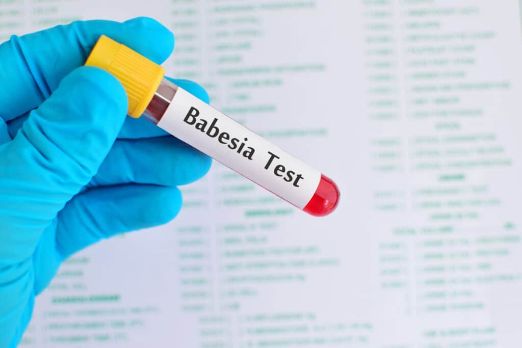 Babesia test