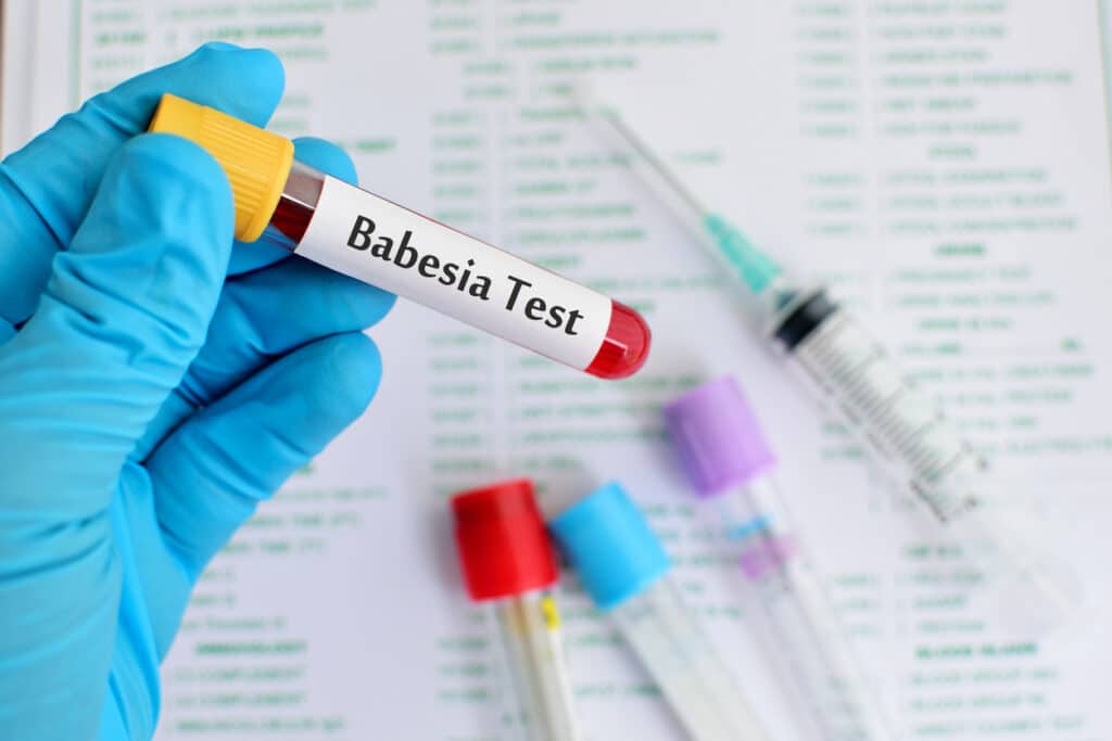 Babesia test