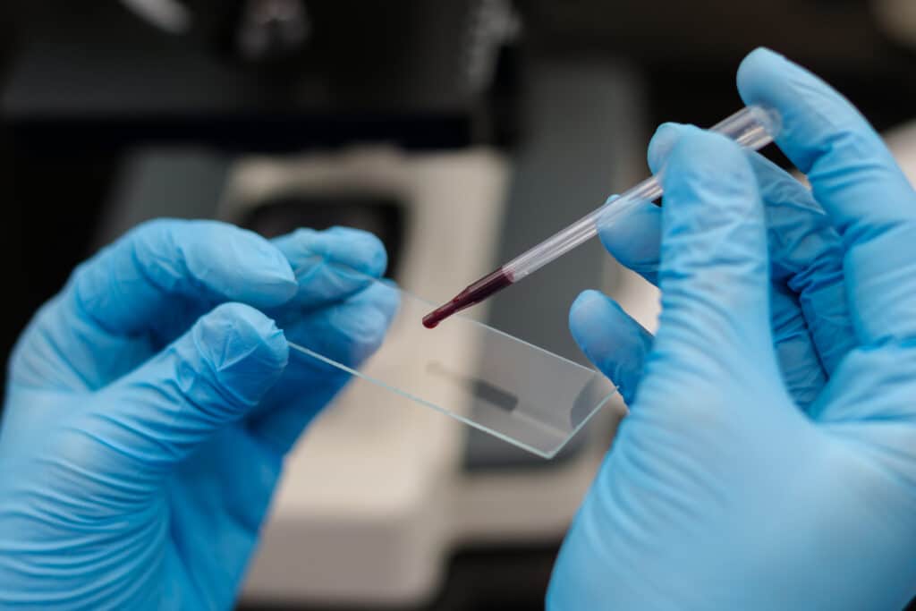 the veterinarian preparing a blood smear