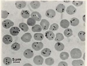 Does Doxycycline Kill Bartonella?