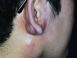 BART NODE ENLARGED images