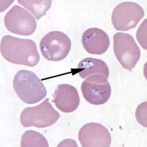 BABESIA IMAGE TWO BABESISA B MO1 thin giemsa arrows
