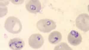 BABESIOA CDC IMAGE bmicrotiDPDx
