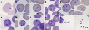 babesia diver bacic image41598 2018 32349 Fig1 HTML
