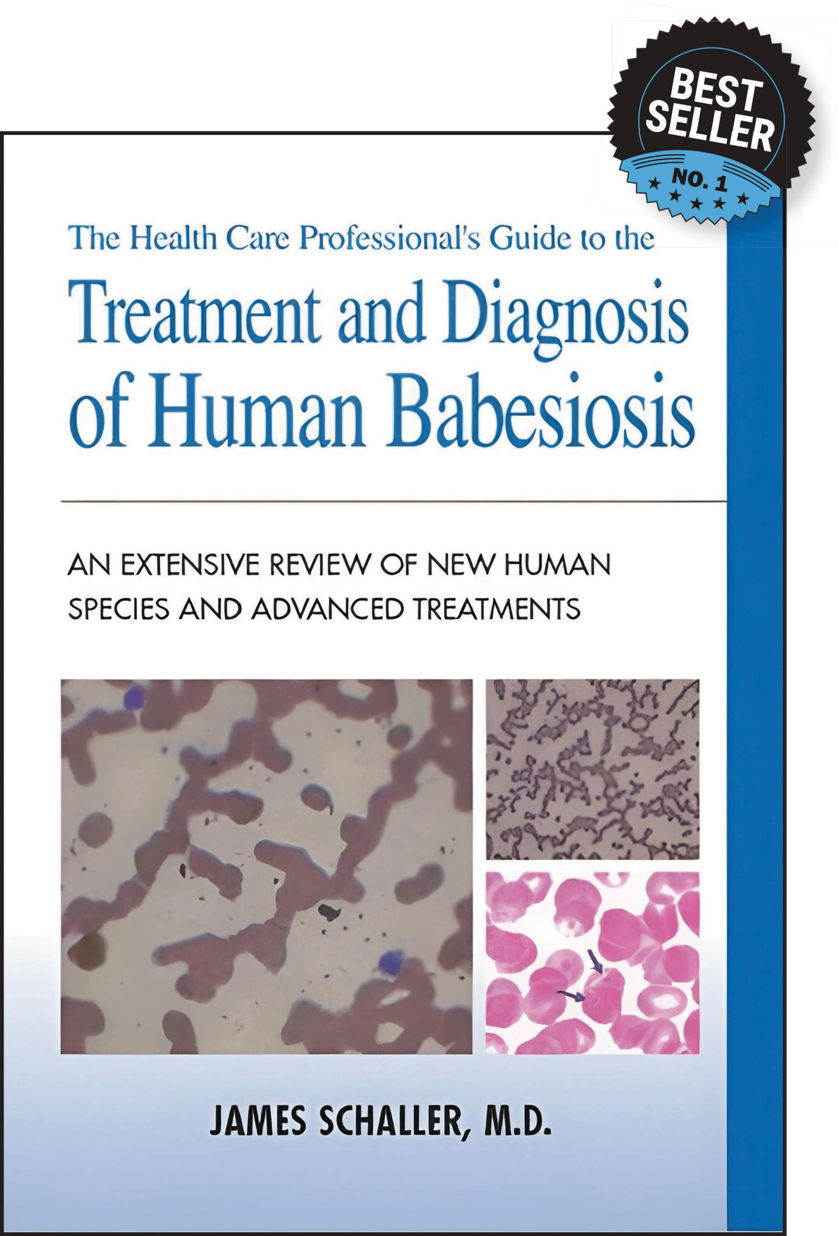 THE HEALTH CARE PROFESSIONAL’S GUIDE TO THE TREATMENT AND DIAGNOSIS OF HUMAN BABESIOSIS