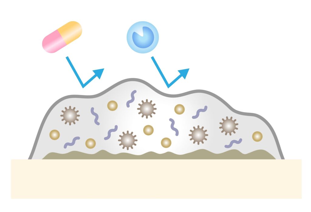 BIOFILMS DEFEAT AB