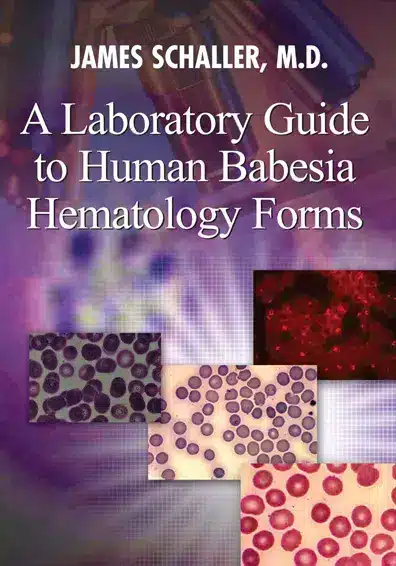 Top Babesia Expert Physician In Florida Are Artemisinin And Artesunate Useful For Treating Babesia?